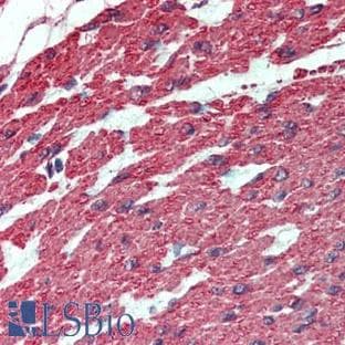 anti-Actin, alpha 2, Smooth Muscle, Aorta (ACTA2) (N-Term) antibody avatar