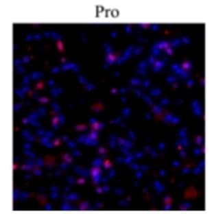anti-Collagen, Type I (COL1) antibody avatar