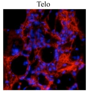 anti-Collagen, Type I (COL1) antibody avatar