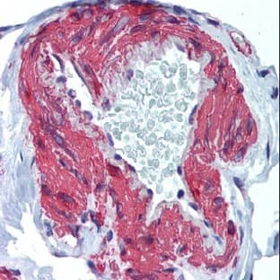 anti-ACTA2 / Aortic Smooth Muscle Actin (N-Term) antibody avatar