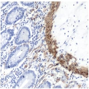 anti-ACTA2 / Aortic Smooth Muscle Actin (N-Term) antibody avatar