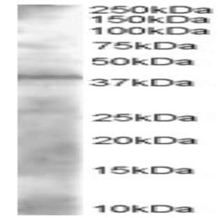 anti-ADH1A + ADH1B + ADH1C (N-Term) antibody avatar