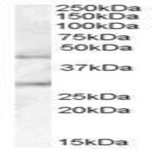 anti-B3GNT2 / B3GALT7 (Internal Region) antibody avatar
