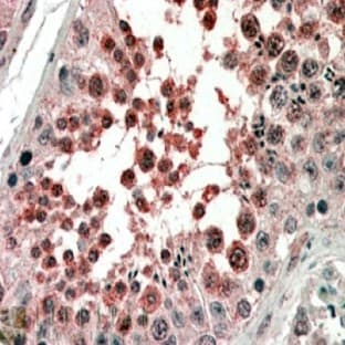 anti-Activin Receptor Type 1 (ACRV1) (Internal Region) antibody avatar