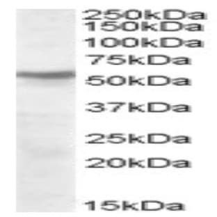 anti-Cholinergic Receptor, Nicotinic, beta 1 (Muscle) (CHRNB1) (Internal Region), (Subunit beta) antibody avatar