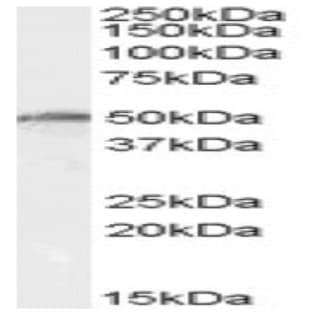 anti-DEAD (Asp-Glu-Ala-As) Box Polypeptide 19A/B (DDX19A/B) (Internal Region) antibody avatar