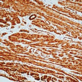 anti-Actin, alpha 2, Smooth Muscle, Aorta (ACTA2) antibody avatar