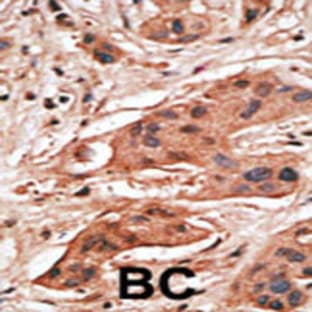 anti-B Cell Leukemia/lymphoma 2 Related Protein A1a (BCL2A1A) (AA 30-65), (BH3 Domain) antibody avatar