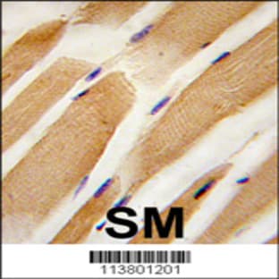 anti-Actin (ACTB/ACTC) (AA 189-218), (Center) antibody avatar