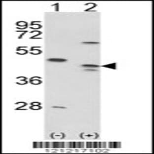 anti-Advanced Glycosylation End Product-Specific Receptor (AGER) (AA 206-234), (Center) antibody avatar