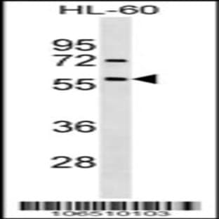 anti-Activin Receptor Type I (ACRV1) (AA 138-170), (Center), (Asn153) antibody avatar