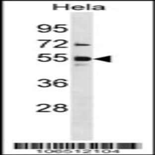anti-Activin Receptor Type I (ACRV1) (N-Term), (AA 6-34) antibody avatar
