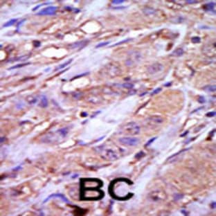 anti-Casein Kinase 1, epsilon (CSNK1E) (C-Term), (AA 331-360) antibody avatar
