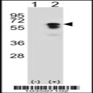 anti-Activin Receptor Type I (ACRV1) (AA 132-162), (Center), (Arg147) antibody avatar