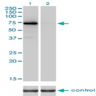 anti-Coagulation Factor II (thrombin) (F2) (AA 263-362) antibody avatar