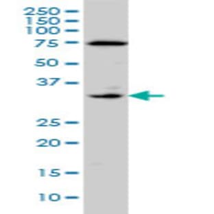 anti-Coagulation Factor III (thromboplastin, Tissue Factor) (F3) (AA 45-155) antibody avatar