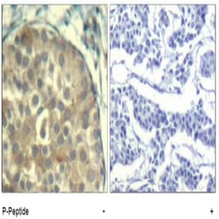 anti-Cofilin1/2 (CFL1/2) (pTyr88) antibody avatar