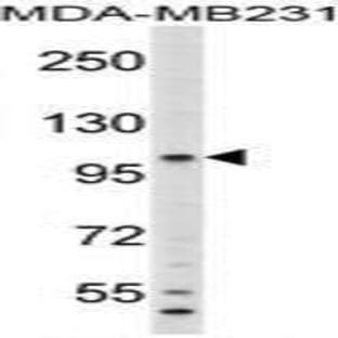 anti-Complement C6 (N-Term) antibody avatar