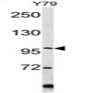 anti-Collagen, Type VI (COL6) (C-Term), (Chain alpha 1) antibody avatar