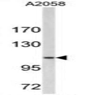 anti-Collagen, Type VI (COL6) (N-Term), (Chain alpha 1) antibody avatar