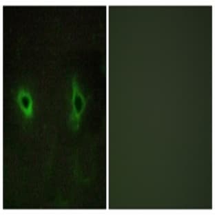 anti-Collagen IV Alpha3 antibody avatar