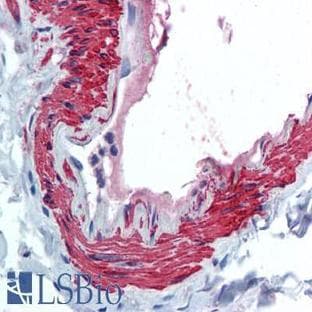 anti-Actin, alpha 2, Smooth Muscle, Aorta (ACTA2) (N-Term) antibody avatar