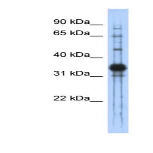 anti-Chondroadherin (CHAD) (Middle Region) antibody avatar