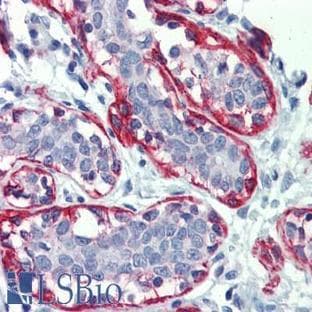 anti-Actin, alpha 2, Smooth Muscle, Aorta (ACTA2) antibody avatar