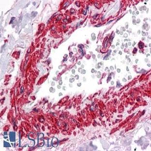 anti-Actin, alpha 2, Smooth Muscle, Aorta (ACTA2) antibody avatar