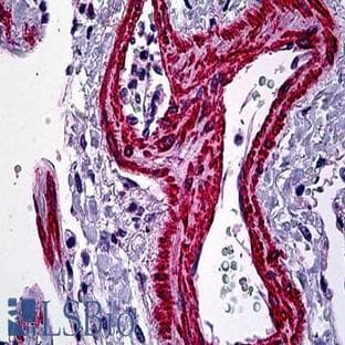 anti-Actin, alpha 2, Smooth Muscle, Aorta (ACTA2) (N-Term) antibody avatar