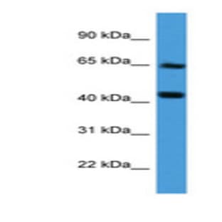 anti-Collagen, Type VIII, alpha 2 (COL8a2) (Internal Region) antibody avatar