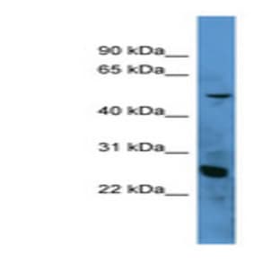 anti-Complement Component 1, Q Subcomponent, A Chain (C1QA) (N-Term) antibody avatar