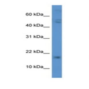 anti-Chorionic Gonadotropin, beta Polypeptide (CGB) (C-Term) antibody avatar