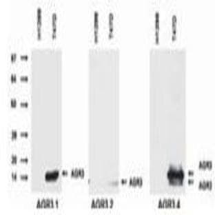 anti-AGR2+AGR3 antibody avatar