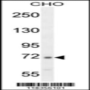 anti-Complement C2 (N-Term), (AA 147-176) antibody avatar