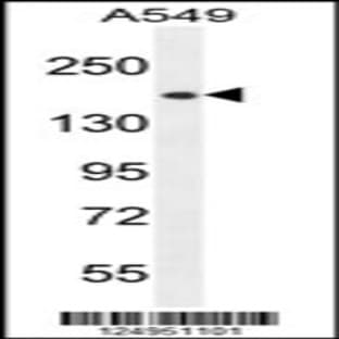 anti-CE164 (N-Term), (AA 246-274) antibody avatar