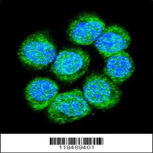 anti-Catenin (Cadherin-Associated Protein), beta 1, 88kDa (CTNNB1) (C-Term), (AA 646-673) antibody avatar