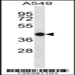 anti-ACTA1/alpha-Actin (C-Term), (AA 346-375) antibody