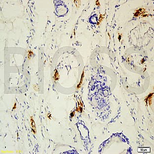anti-Collagen X antibody avatar