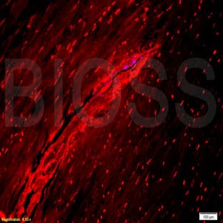 anti-Collagen, Type I (COL1) (C-Term) antibody avatar