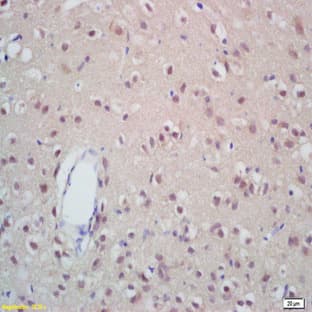 anti-Centromeric Histone H3-Like Protein-1 antibody avatar