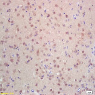 anti-Centromeric Histone H3-Like Protein-2 antibody avatar