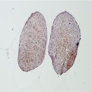 anti-Collagen, Type II (COL2) antibody avatar