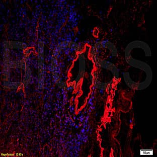 anti-Collagen, Type IV (COL4) antibody avatar