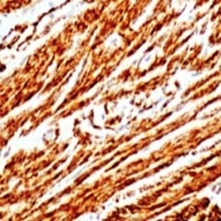 anti-ACTA2 / Aortic Smooth Muscle Actin antibody avatar