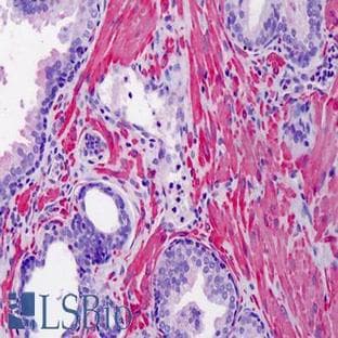 anti-Actin, alpha 2, Smooth Muscle, Aorta (ACTA2) antibody avatar