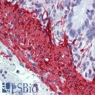 anti-Actin, alpha 2, Smooth Muscle, Aorta (ACTA2) (N-Term) antibody avatar