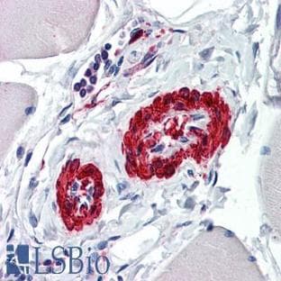 anti-Actin, alpha 2, Smooth Muscle, Aorta (ACTA2) antibody avatar