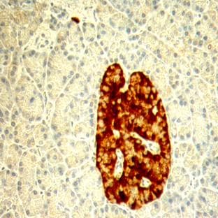anti-Chromogranin antibody avatar