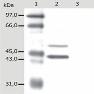 anti-Cytokeratin 5/18 antibody avatar